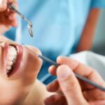 Opalescence Teeth Whitening: Your Luxurious Solution To Sparkling Teeth